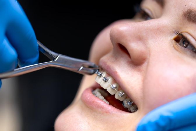 Orthodontist SEO